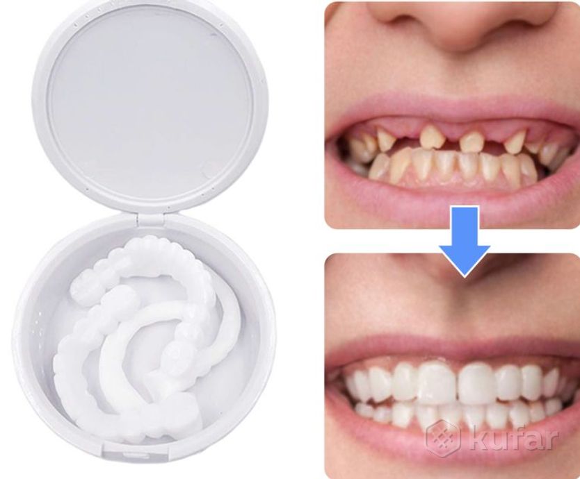 фото накладные виниры для зубов snap-on smile/съемные универсальные виниры 2 шт.(верх и низ) 5