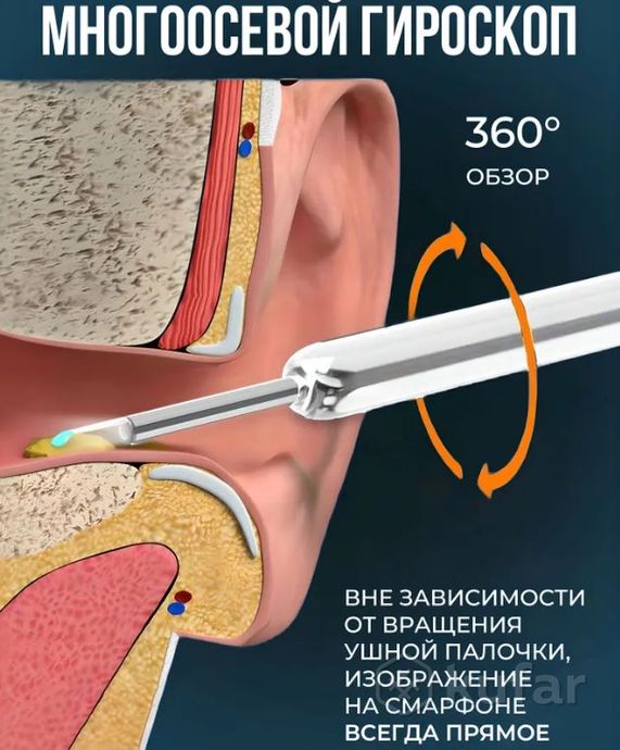 фото умная ушная палочка с камерой (отоскоп) для чистки ушей wireless visual earpick ne3 черный 1